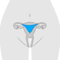 子宮