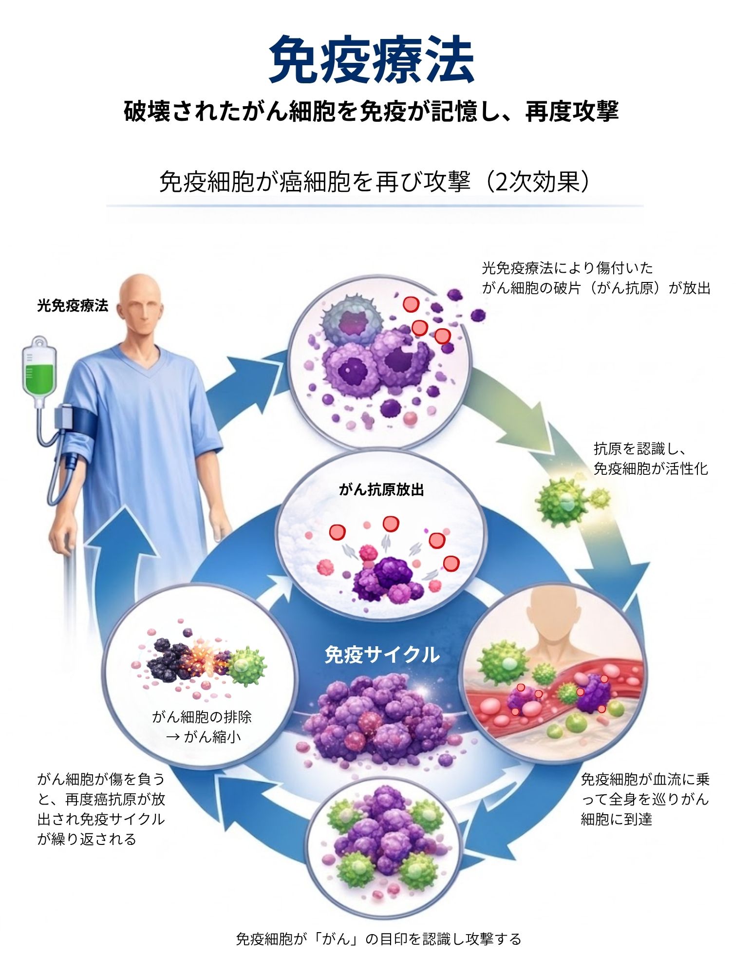 免疫療法